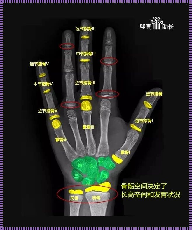 育儿秘籍：揭秘测骨龄的神秘面纱