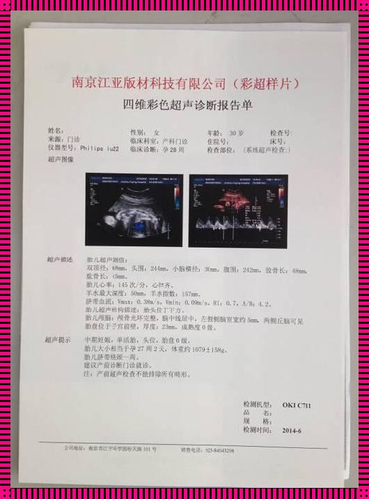 女性彩超和b超的区别：备孕路上的 scan 秘籍