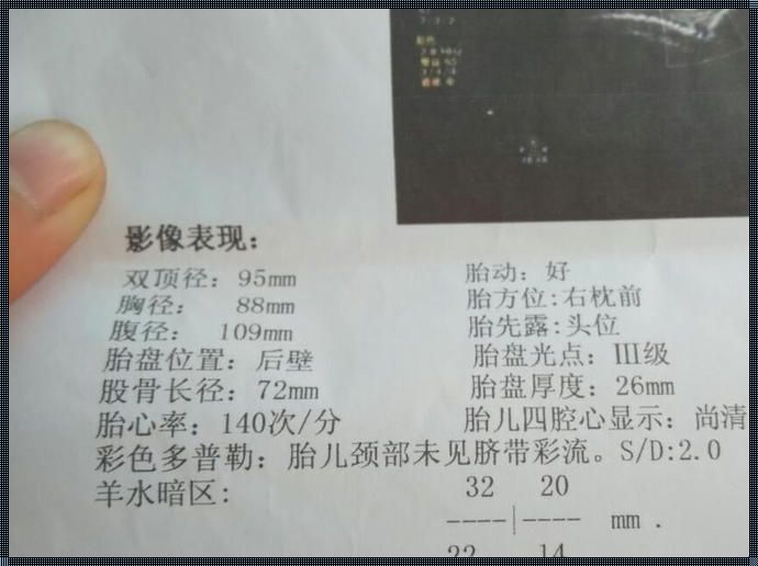 备孕路上的一项费用：单做一个B超的价格解析