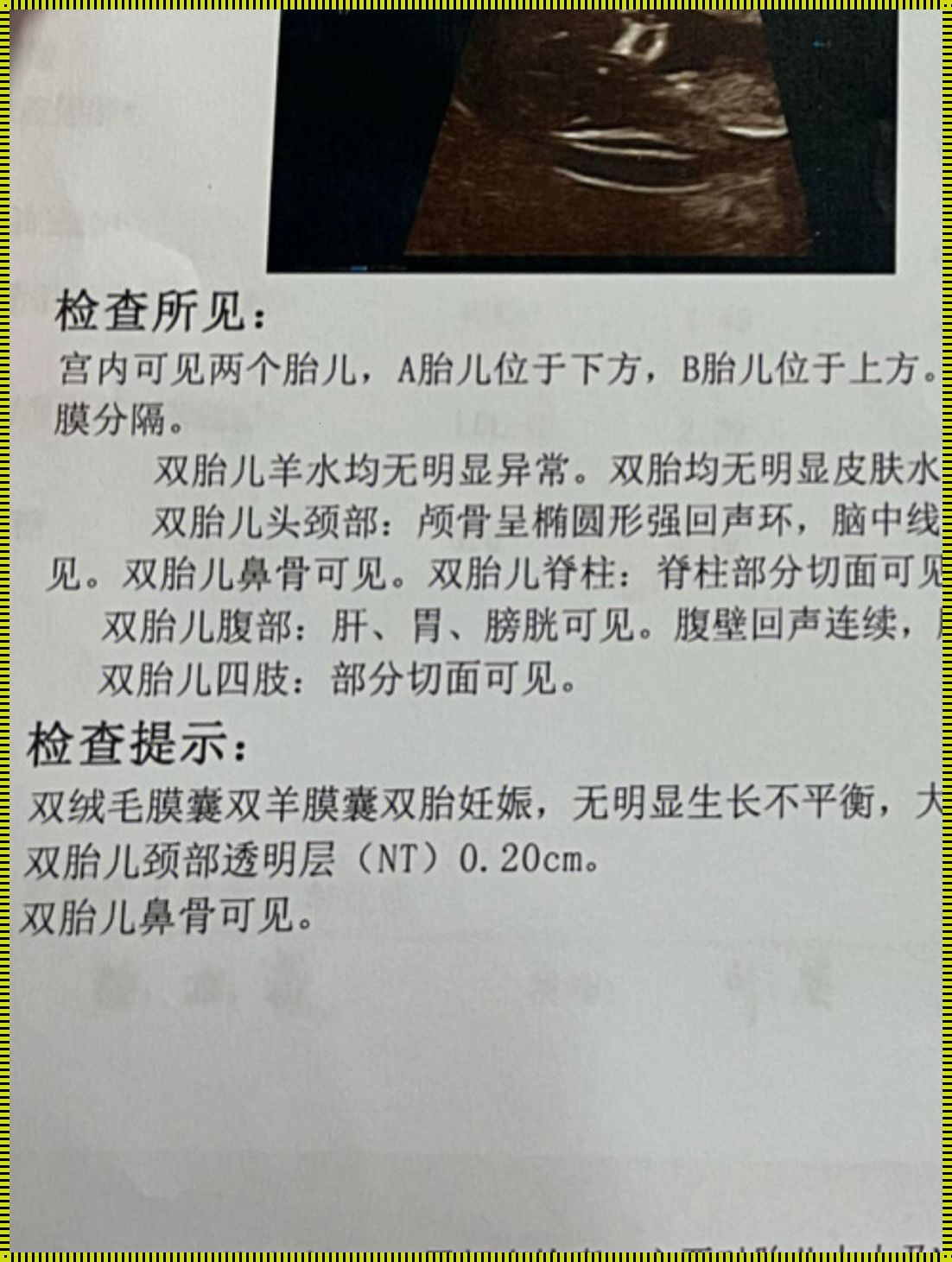 双胎惊喜降临，揭秘自然受孕双胎背后的身体秘密