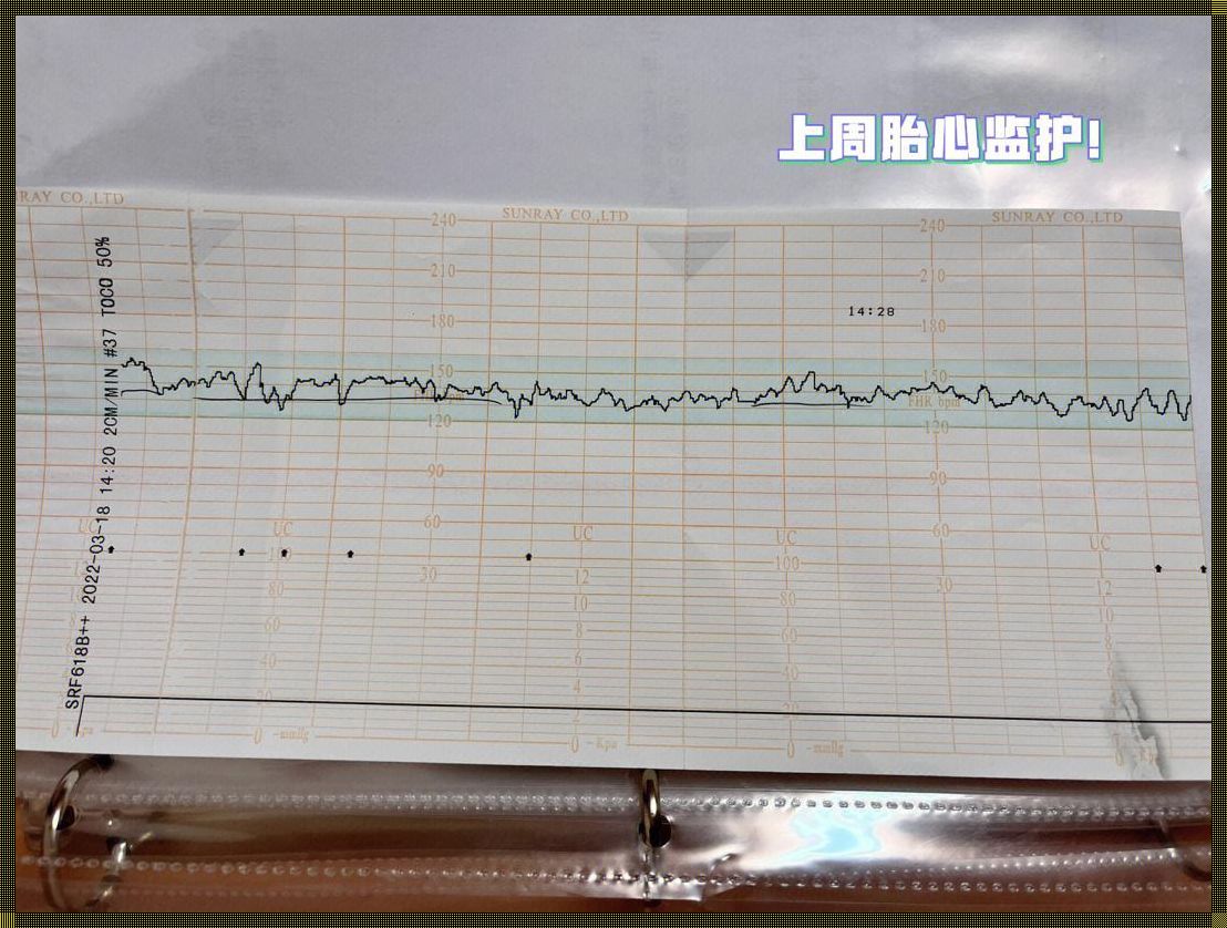 备孕胎监toco值异常解析：如何应对超过20低于50的情况？