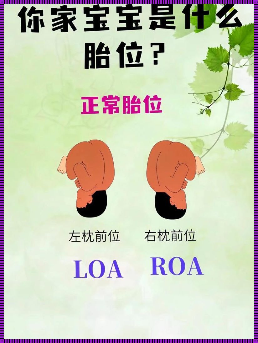 揭秘ROP胎位：顺产还是剖腹产，你得听我的！