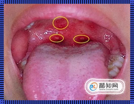 惊呆了！嘴唇上的小秘密：育儿界的“蛔虫探测器”