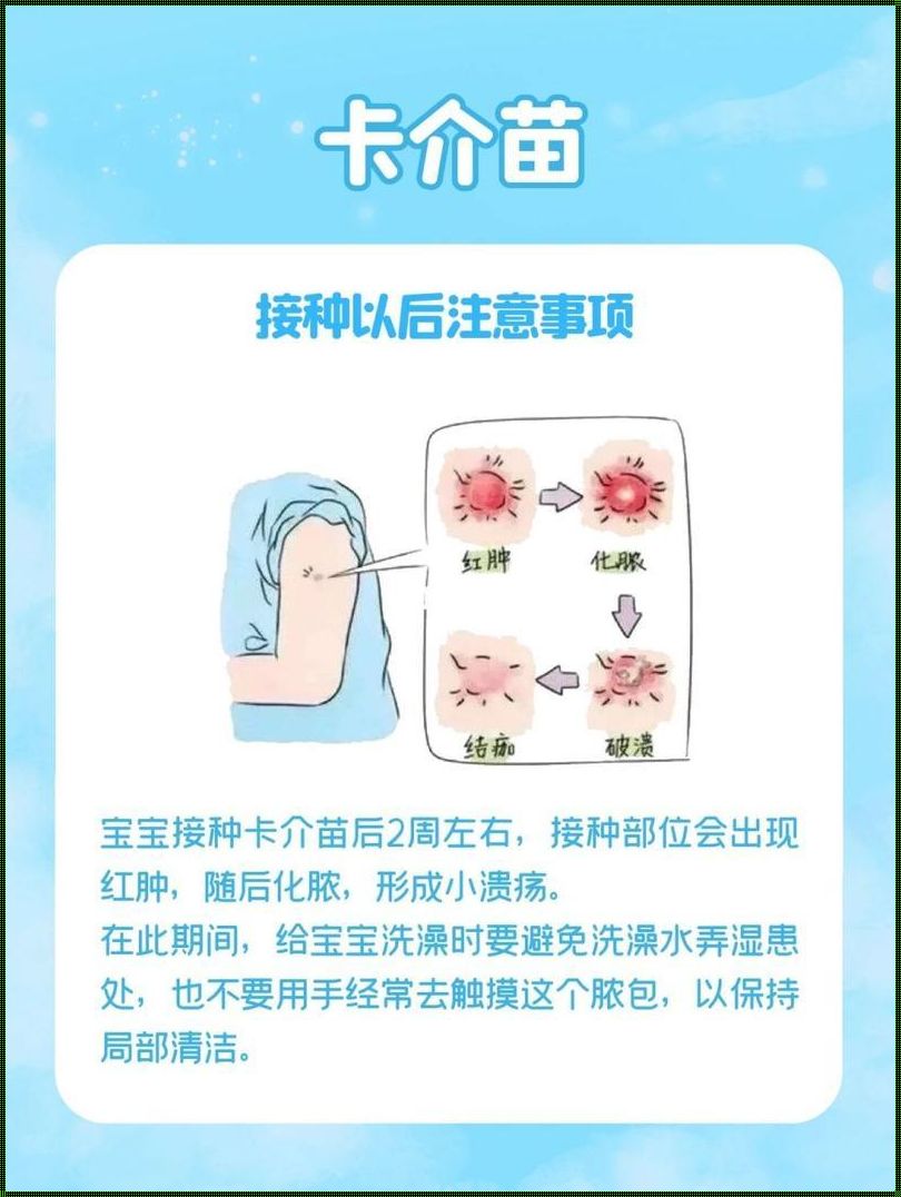 卡介苗：必要的疫苗接种