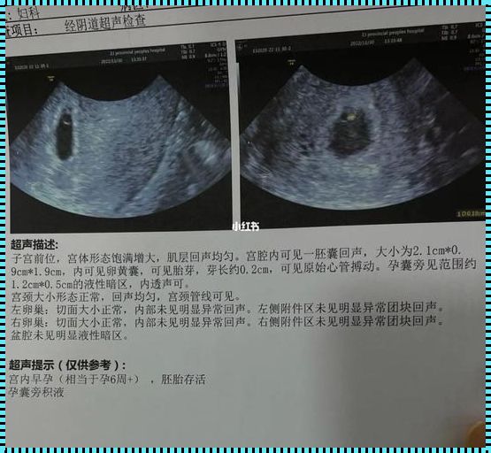 孕囊大胎芽小，揭秘生命最初的“住房问题”