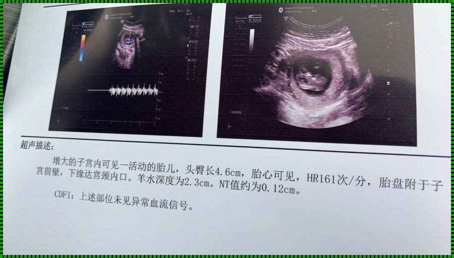 “前壁生男”揭秘：风水学说还是调皮命运？