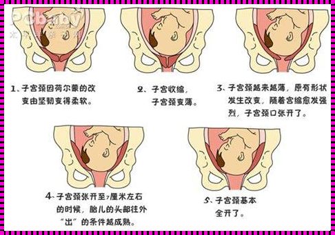 剖腹产一般几天不疼了：调皮妈妈的“战后”恢复了