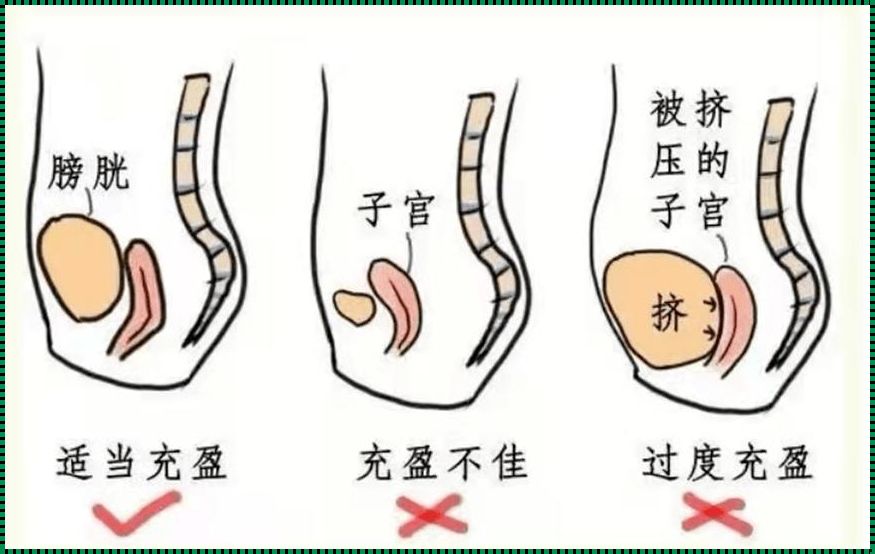 阴超和腹部B超，哪个更靠谱？