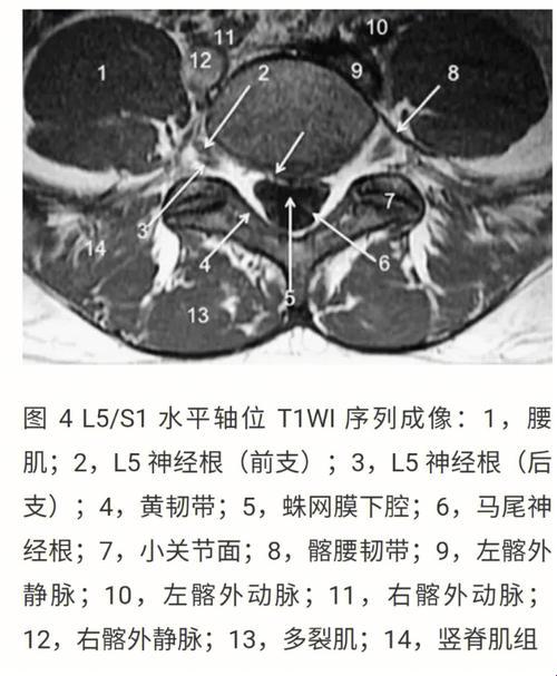 “瞧瞧，这就是你的大脑秘密花园！”——自己动手解密磁共振片子