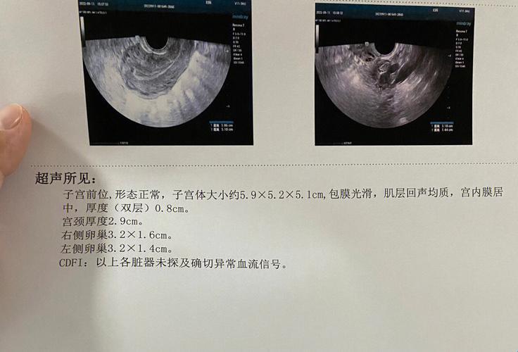 “大月份引产血”溜达多久才算干净？幽默版夸张解读！