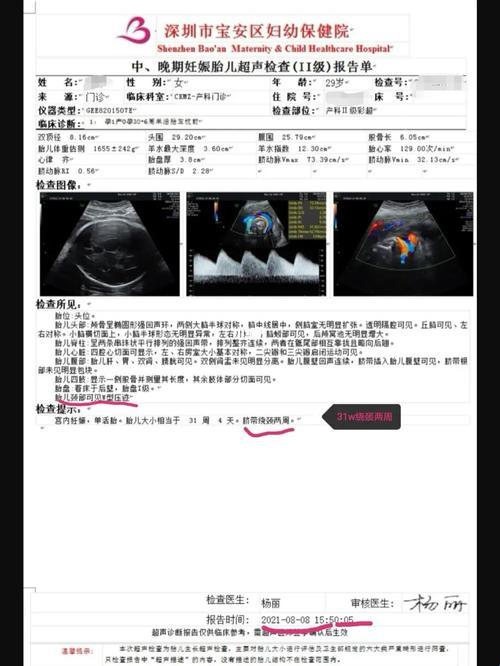 38周绕颈两周，好生不易，笑谈孕期风云