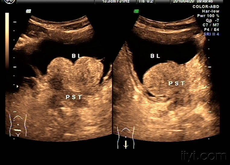 “腺”界奇观：7mm的“强”波传说