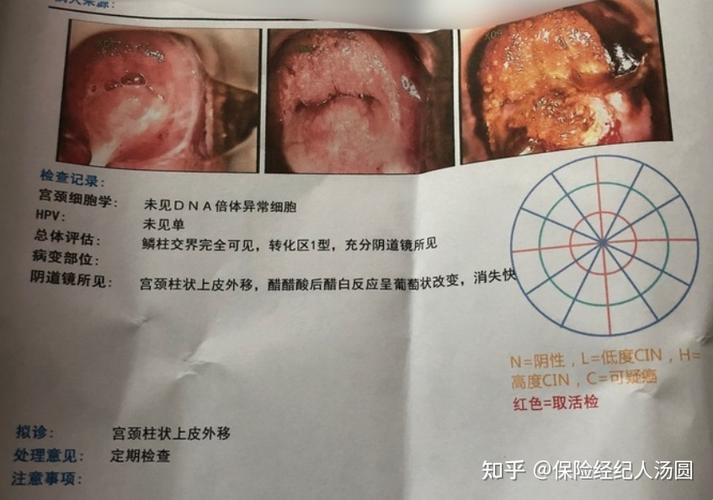 “宫颈炎”查查查，笑谈生活怪现状