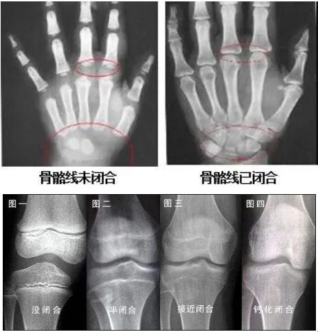 骨碌碌，半闭半合，还能蹦跶几厘米？