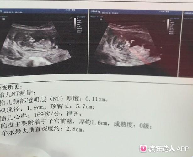 171跳动的‘男’儿心：笑谈性别预言的荒诞