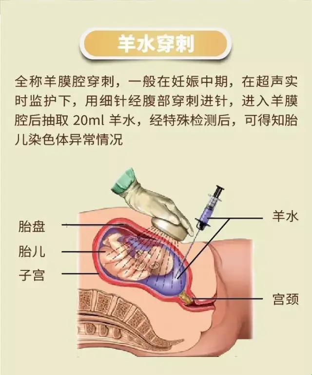 做羊穿，难道小宝贝就一定有问题？