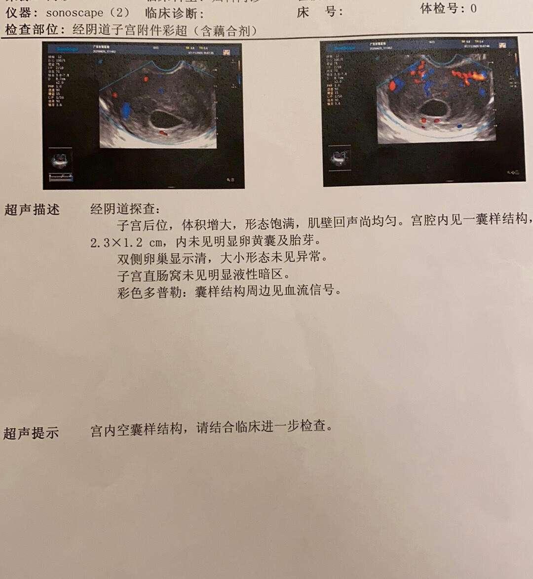 “空囊”的秘密：揭秘那些让人抓狂的征兆