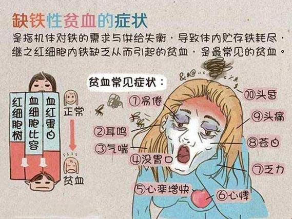 孕妇贫血，揭秘“红颜”背后的苦涩