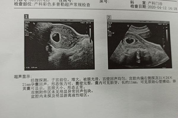 着床早，男孩闹：自嘲式揭秘生育密码