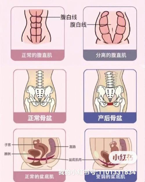 那些年，我们没有盆底肌修复