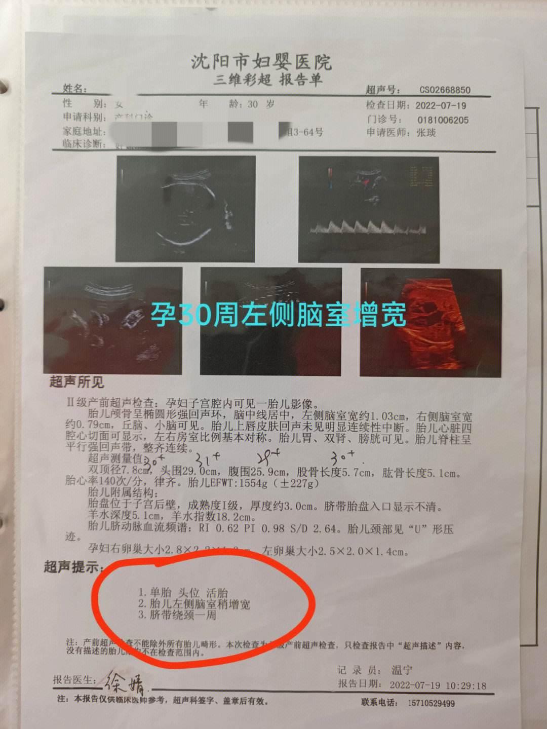 脑室侧畔，孕周漫漫：笑谈对照表里的喜怒哀乐