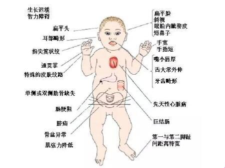 孩子不是唐氏的惊天秘密：笑谈中解锁基因密码