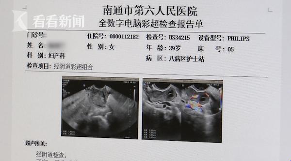 B超风波：宫内宫外，揭秘时刻