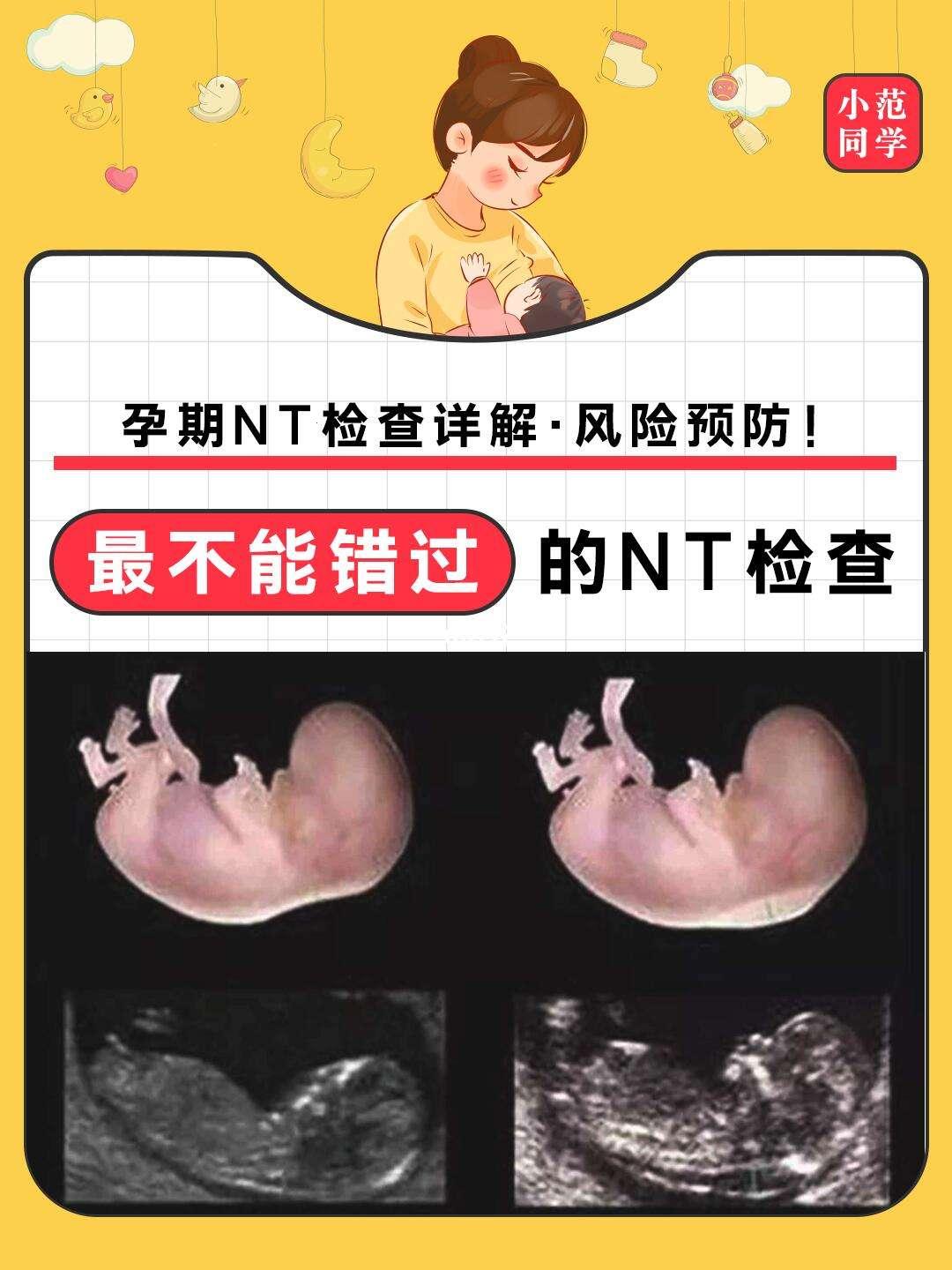 NT不用空腹吧 — 荒诞笔下的胡言乱语