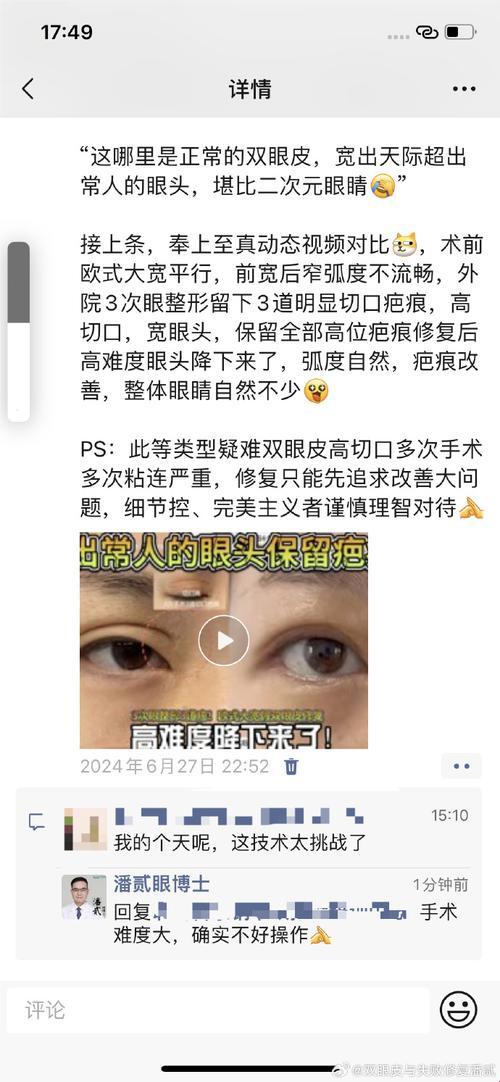 哪些人“不适合”割双眼皮？讽刺大观园里的“定制”美