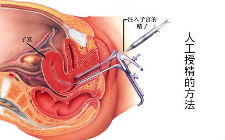 38岁人工授精成功，荒诞or奇妙？