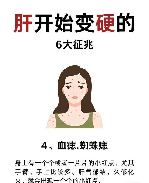 女性血痣之谜：探秘身躯上的红颜印记