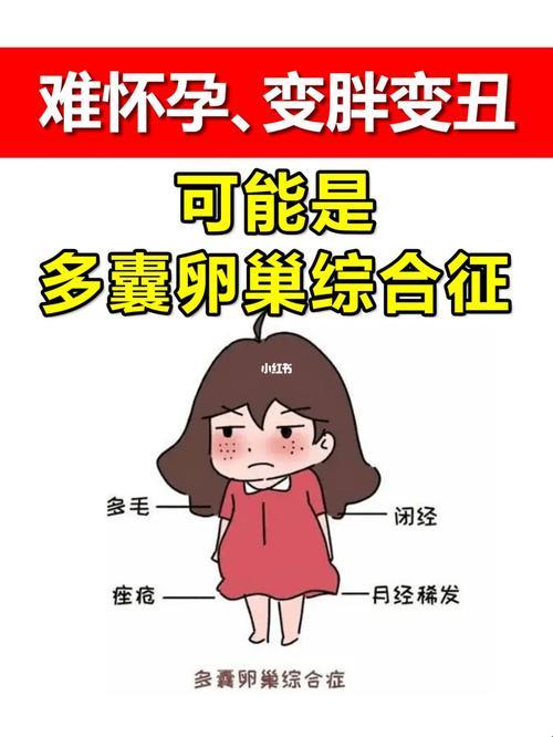 “多囊”30岁后，怀孕之路喜剧之王之路？