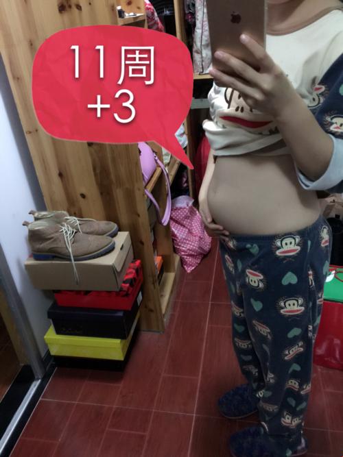 肚子长毛，生男生女概率何在？