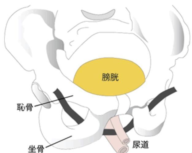 尿道悬吊术：能顶几年，幽默揭秘！