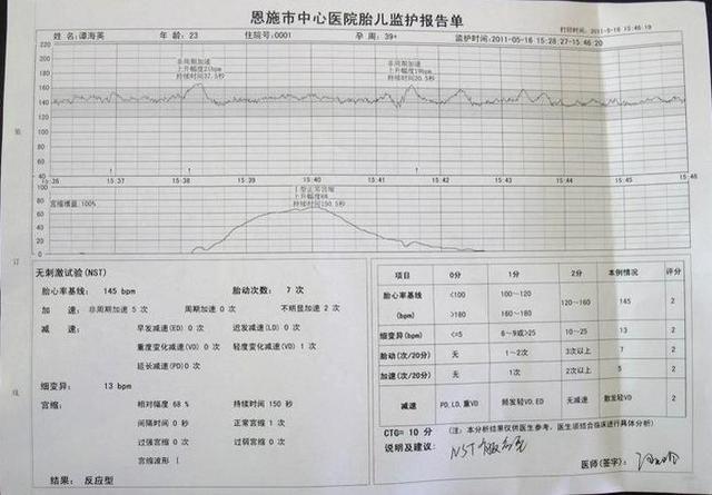 胎心率高，是猴儿还是牛？