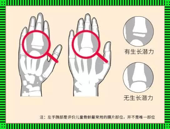 摸骨探秘，笑谈成长之奥秘