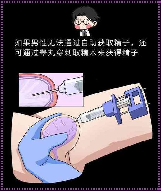 精彩纷呈，提前放水的艺术：男士取精前的排精大作战