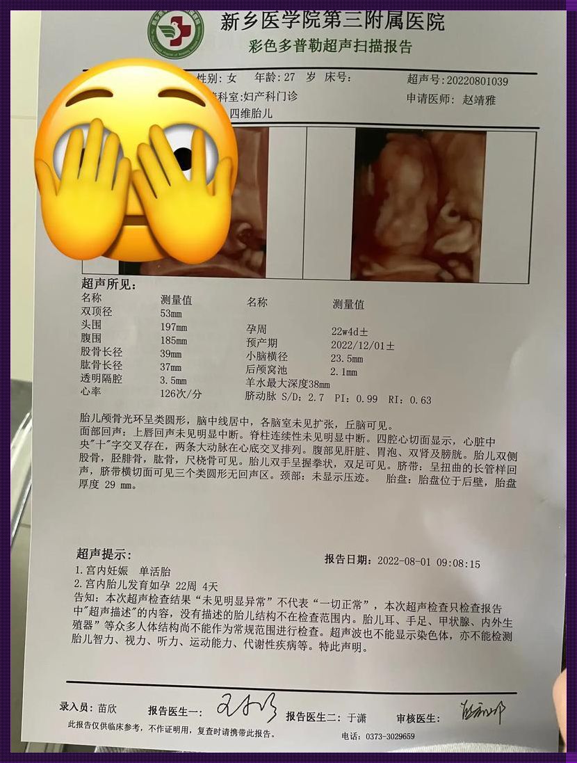 四维单子mi大于1，性别秒变女神：这世道，数值说了算！