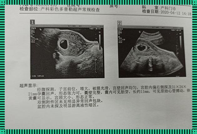 “快男快女”谜题：胎芽速度的性别猜想