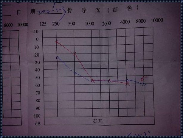 电测听过不了，难道耳朵真有“瑕疵”？