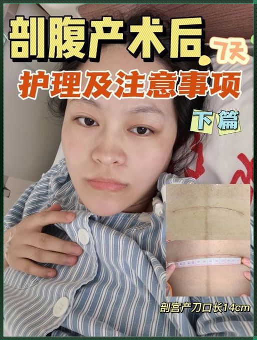 《术后发烧，硬核剖析剖腹产“高烧”何时休》