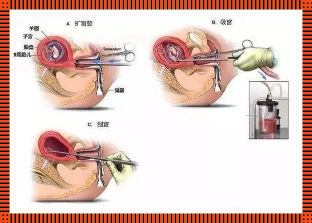 “宫腔镜人流”：狂欢背后的荒诞剧场