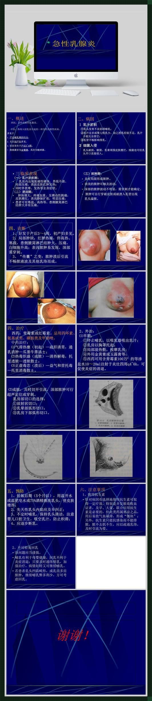 乳腺炎反复发作？妈呀，这简直是胸口的“不定时炸弹”！