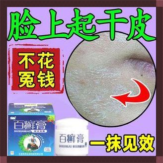 脸上“花斑”整治记：笑谈药用膏霜的妙用