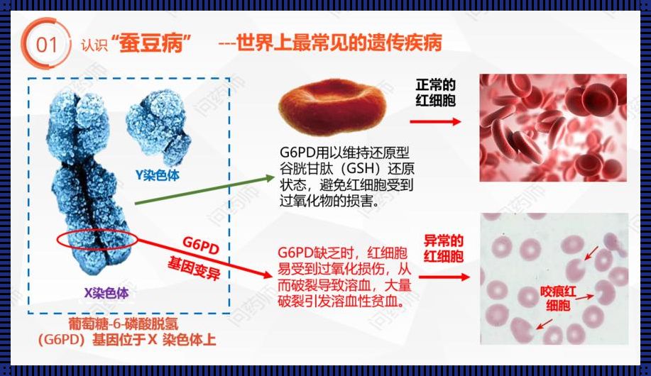 蚕豆病，一场生化舞台的荒诞剧