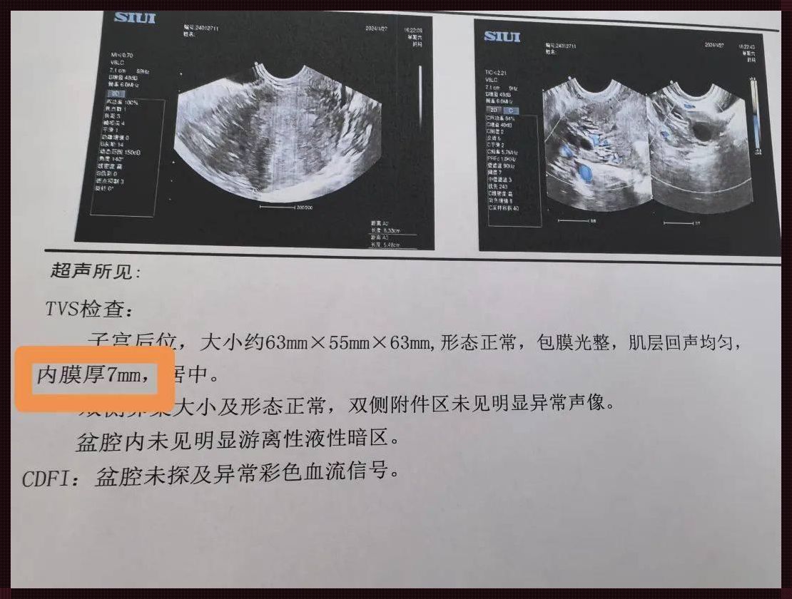 B超探秘：宫腔粘连能否一窥究竟？