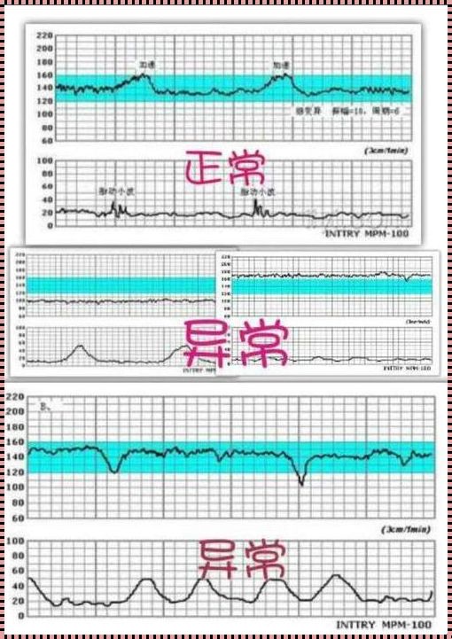 胎心多少才缺氧，幽默揭秘胎儿“缺氧门”