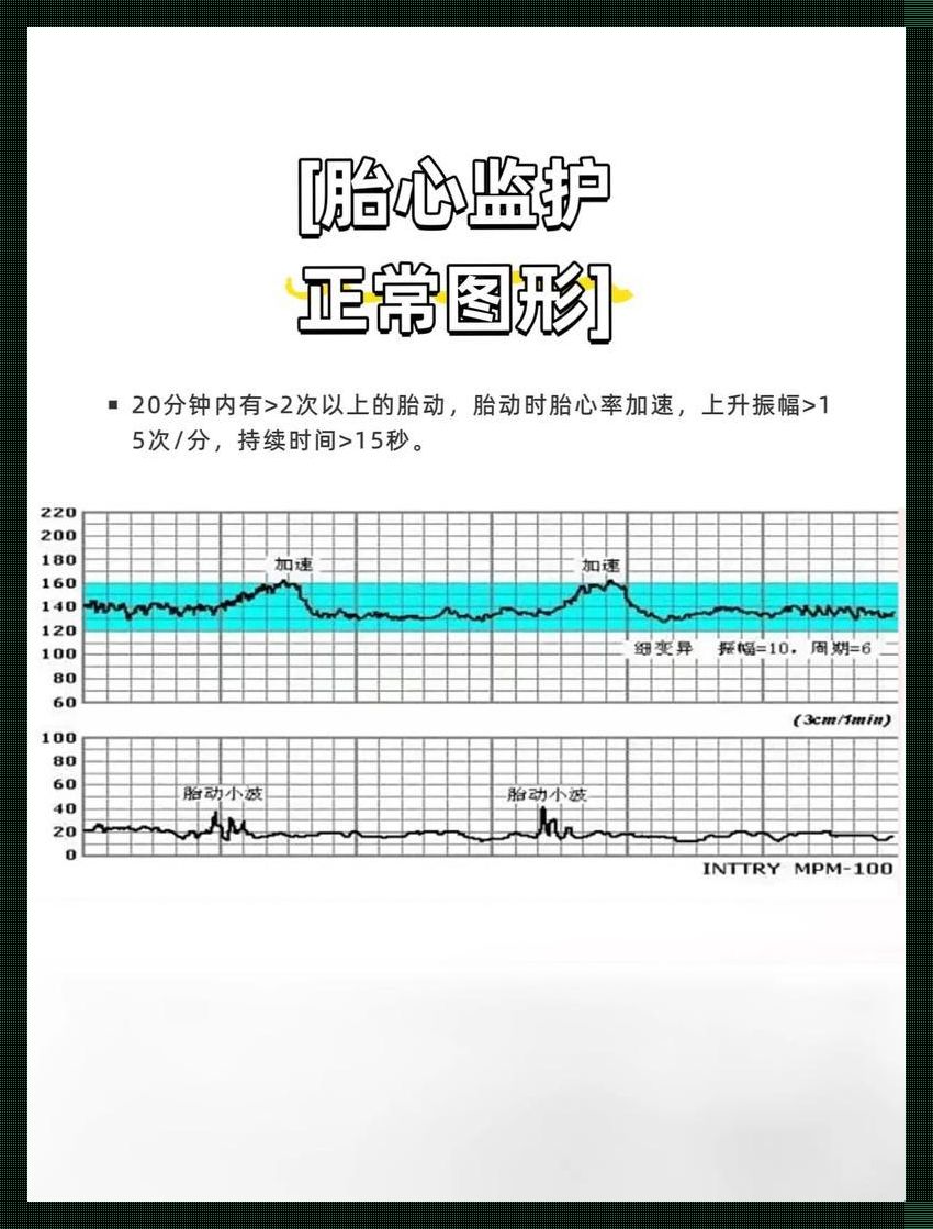 胎心音大揭秘：笑谈胎儿心跳的奥秘与辨识神技