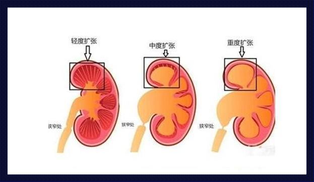 “肾盂分离”=性别暗示？医生言论引爆瓜田！