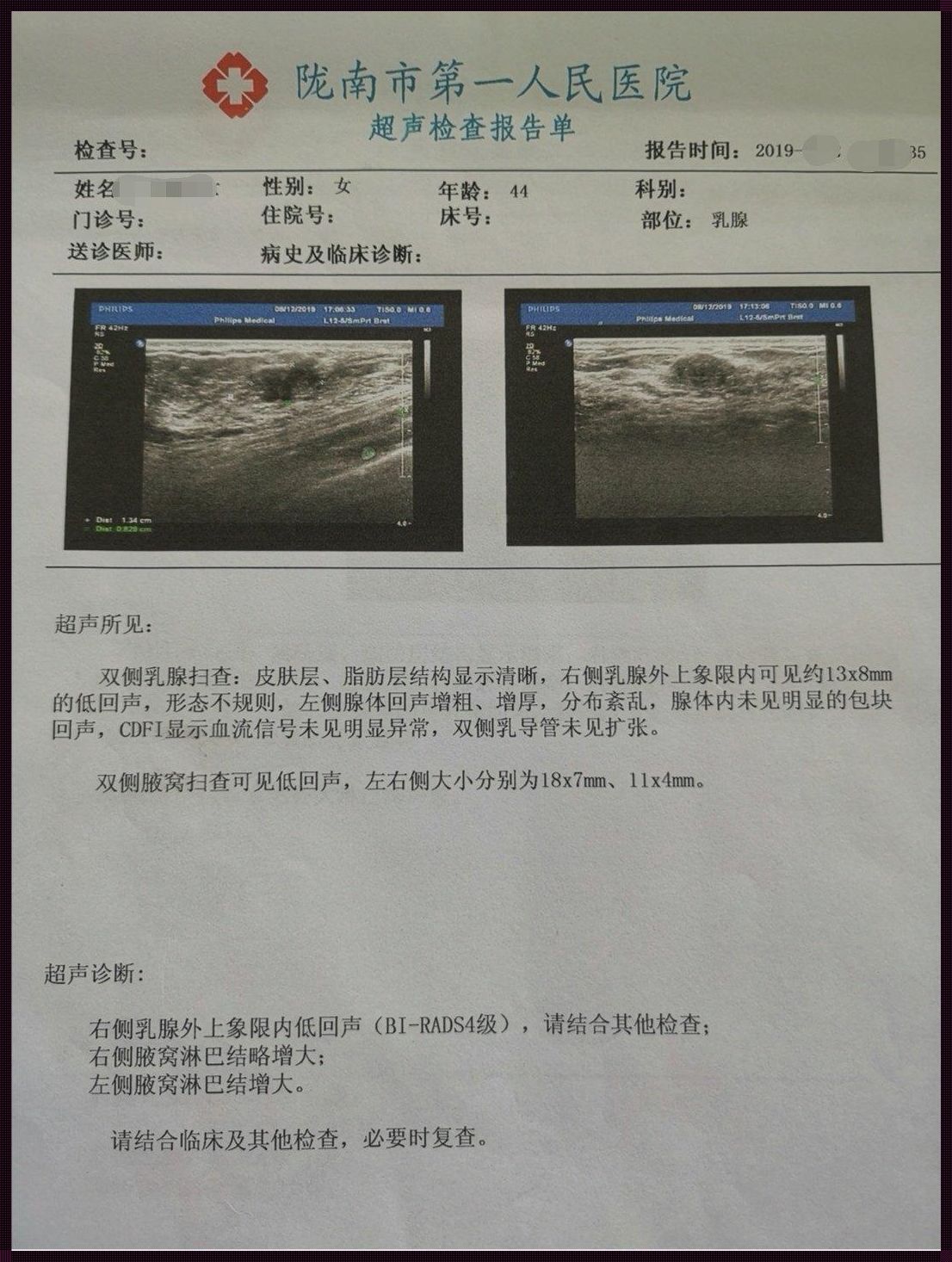 大姨妈驾到，乳腺彩超要刹车？